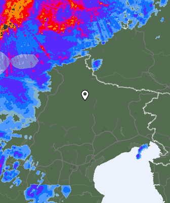 Radar