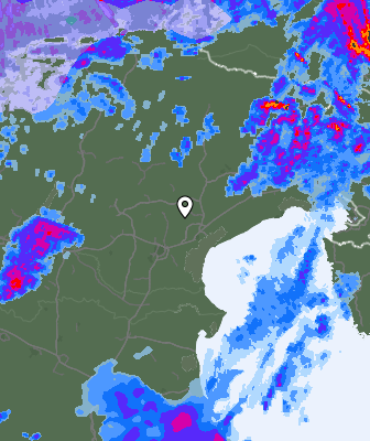 Radar
