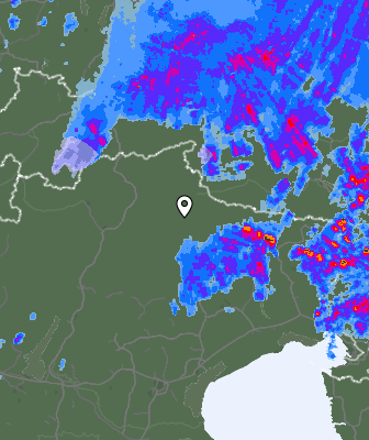 Radar