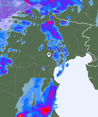 Radar