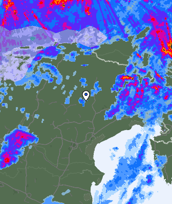 Radar
