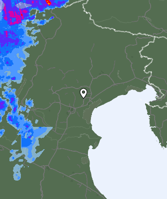 Radar