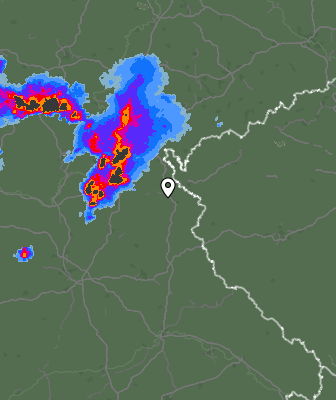 Radar