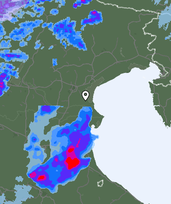Radar