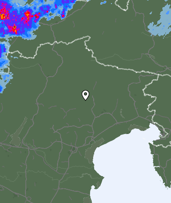 Radar