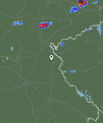 Radar