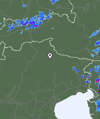 Radar