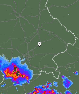 Radar