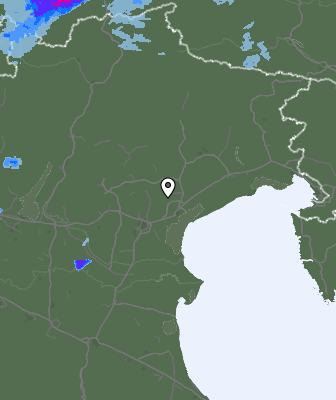 Radar