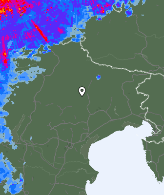 Radar