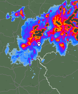 Radar