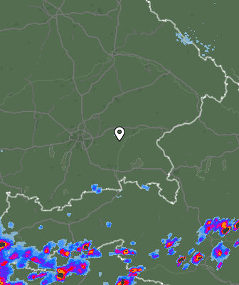 Radar
