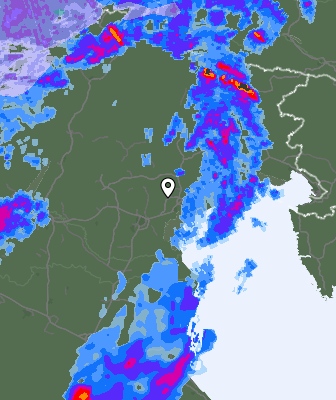 Radar