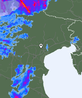 Radar