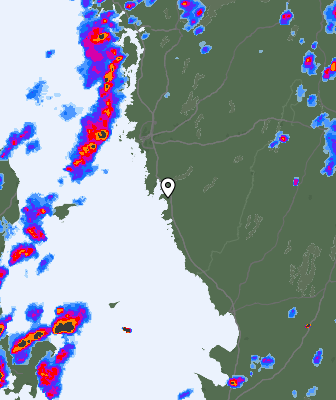 Radar
