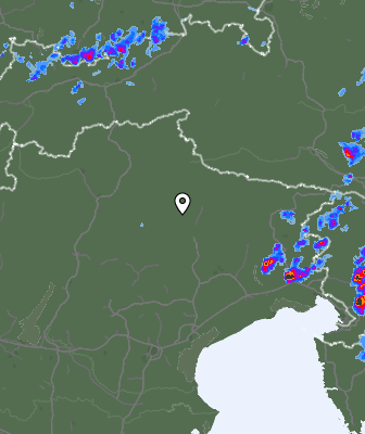 Radar