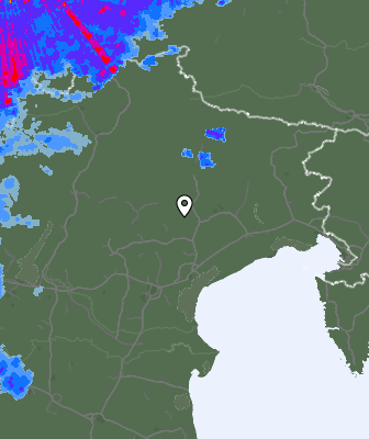Radar