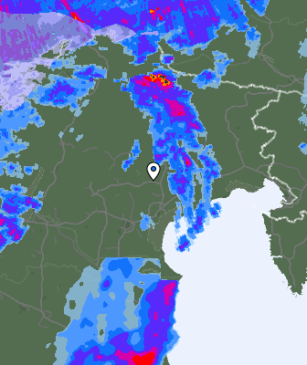 Radar