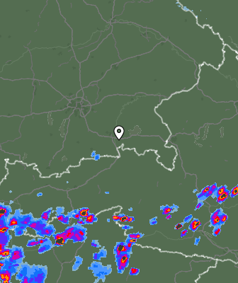 Radar