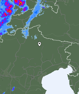 Radar