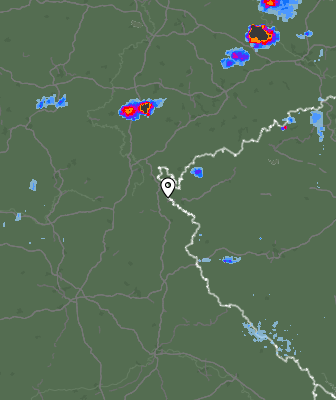 Radar