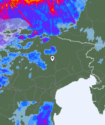 Radar