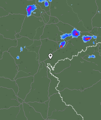 Radar
