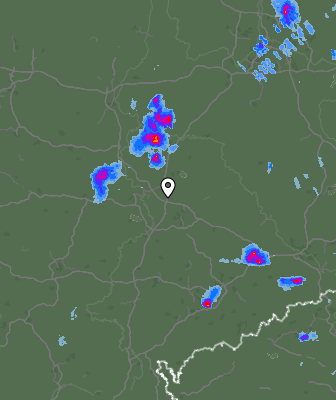 Radar