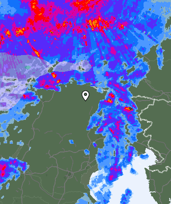Radar