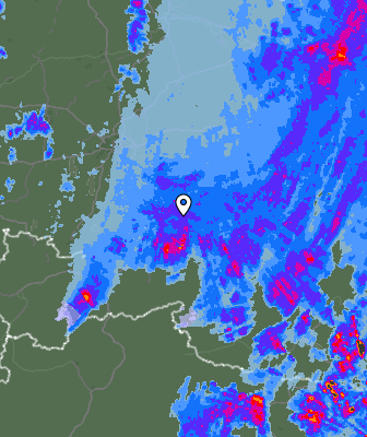 Radar