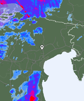 Radar