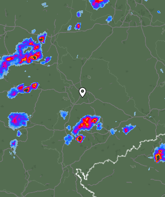 Radar
