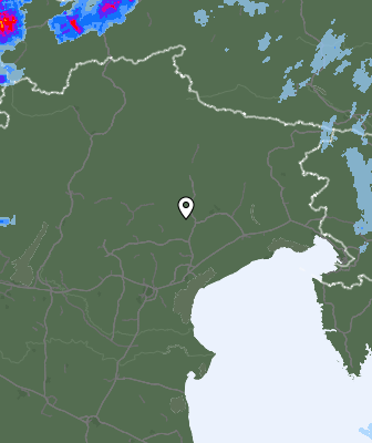 Radar