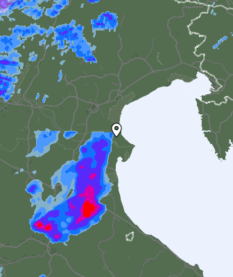 Radar