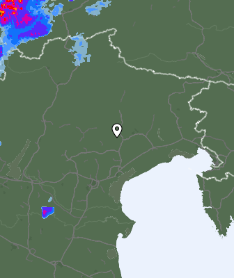 Radar