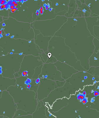 Radar
