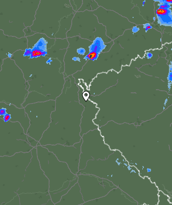 Radar