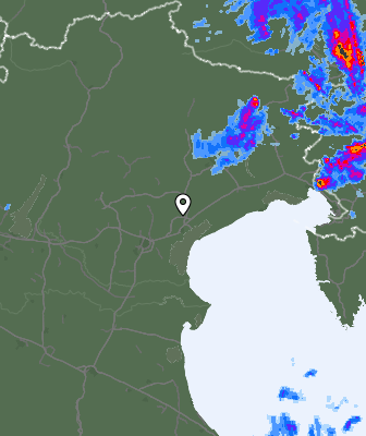 Radar