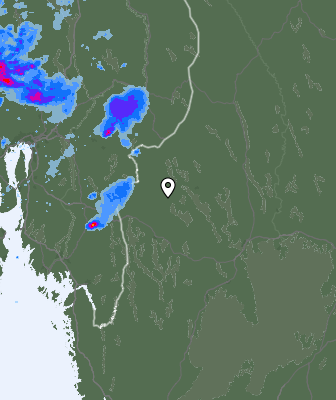 Radar