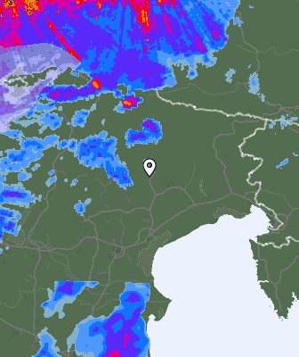 Radar