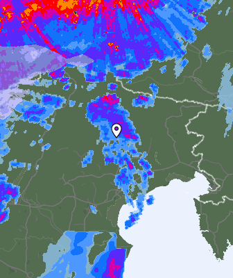 Radar