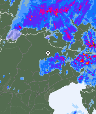 Radar