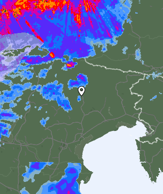 Radar