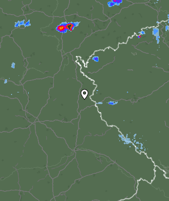 Radar