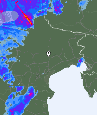 Radar