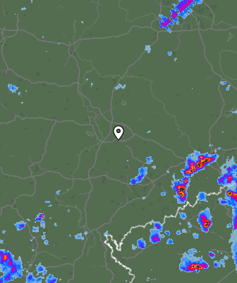 Radar