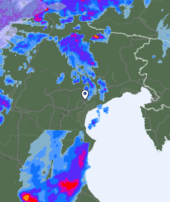 Radar