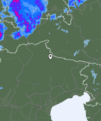 Radar