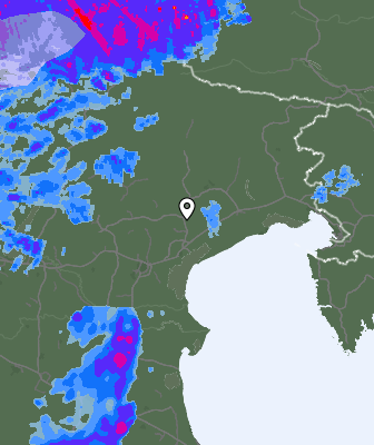 Radar