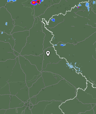 Radar